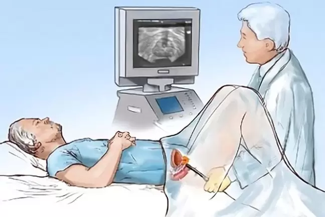 prostatitisaren diagnostikoa